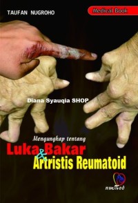 Mengungkap Tentang Luka Bakar &Artistis Reumatoid