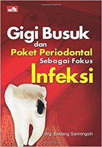 Gigi Busuk dan Poket Periodontal sebagai Fokus Infeksi