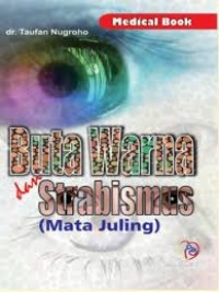 Buta Warna Dan Strabismus (Mata Juling)