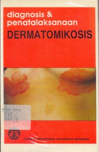 Diagnosis & Penatalaksanaan Dermatomikosis