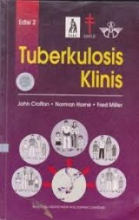 Tuberkolosis Klinis