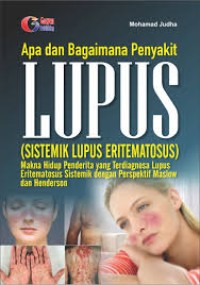 Apa Dan Bagaimana Penyakit Lupus(Sistemik Lupus Eritematosus)